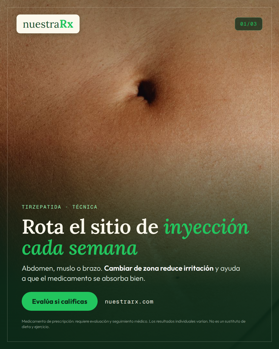 Tirzepatida: rotación de sitios, técnica y moretones