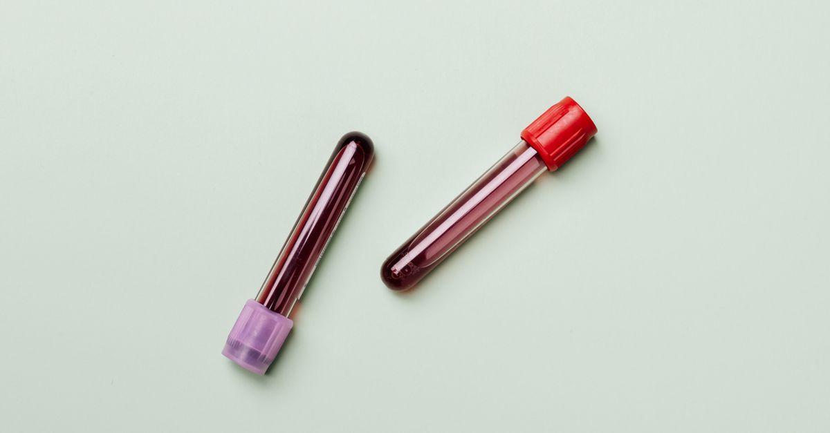 GLP-1 y análisis de sangre: ¿Qué necesitas saber para tu salud?