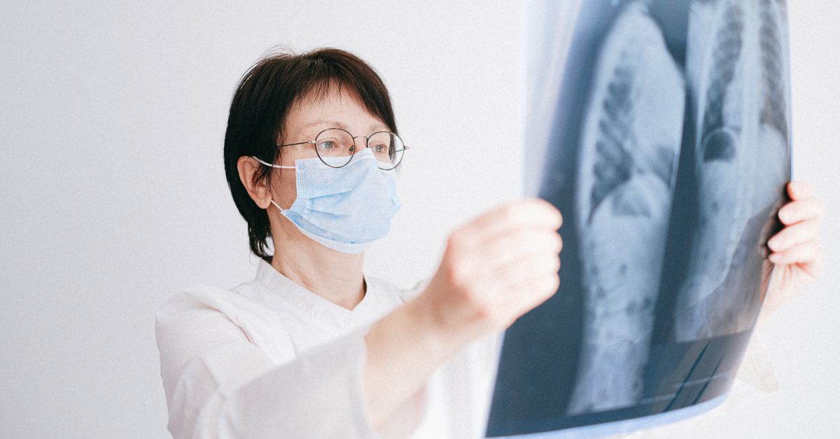 Doctor analyzes lung x-ray wearing a mask in a clinical setting.